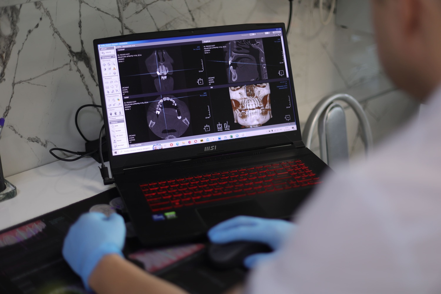 ИМПЛАНТАЦИЯ 